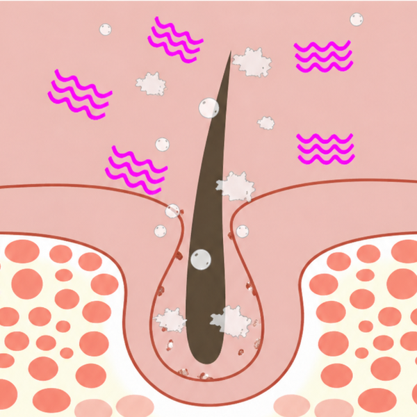 Deep Pore Penetration →